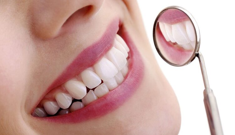 An Overview of the Different Types of Probiotic Dental Supplements